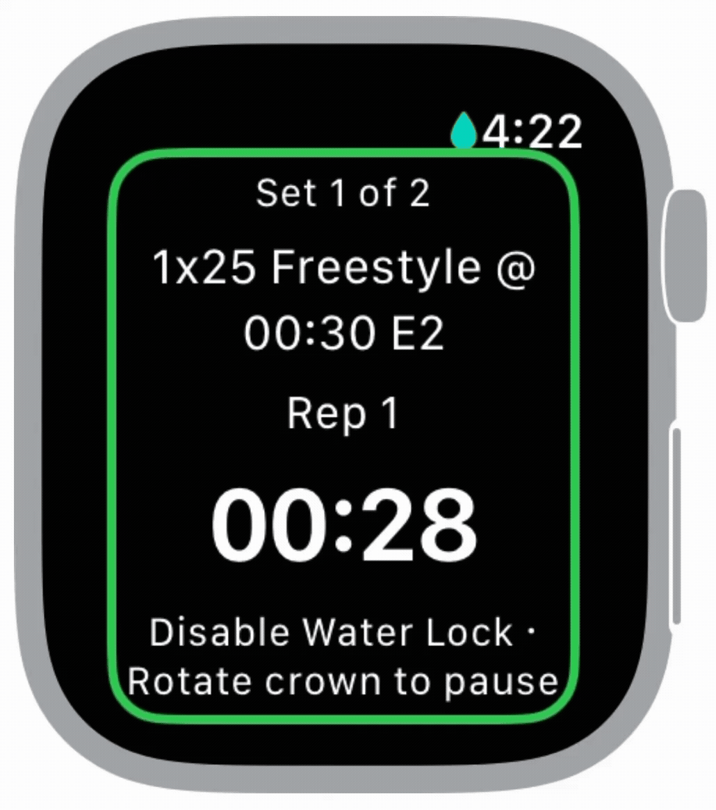 View set on watch